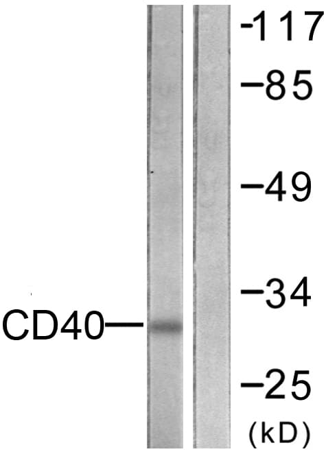 CD40 Antibody (aa228-277)