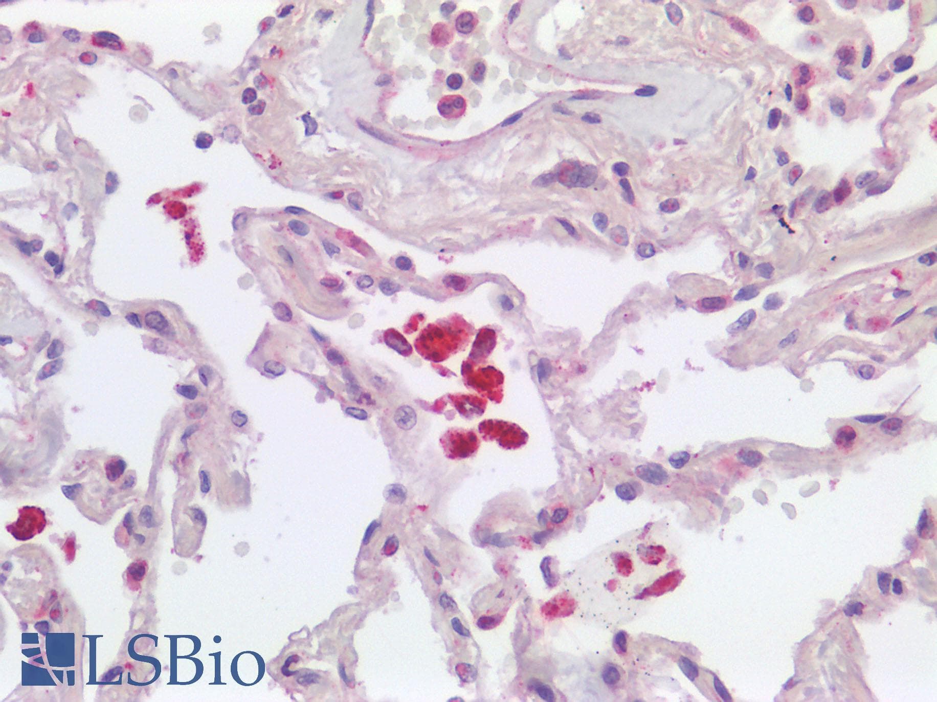 IHC-plus™ Polyclonal Rabbit anti-Human CTSL / Cathepsin L Antibody (IHC)