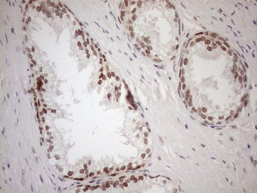 Monoclonal Mouse anti-Human MGMT Antibody (clone OTI2F10, IHC, WB)