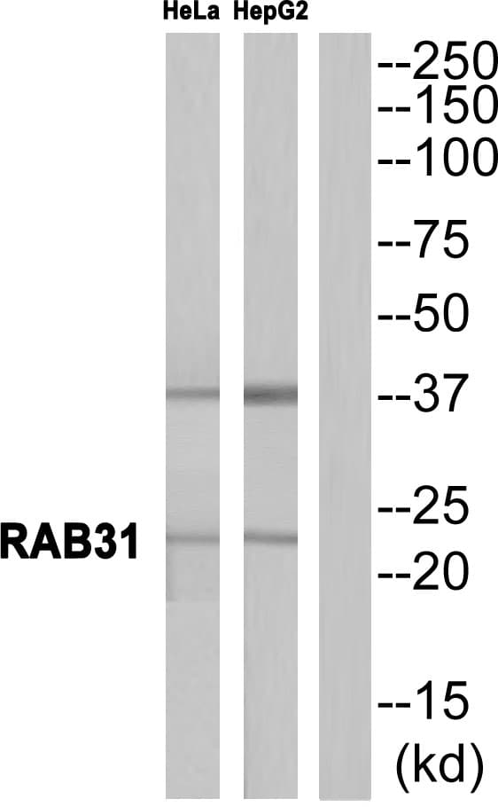 Polyclonal Rabbit anti-Human RAB31 Antibody (WB)
