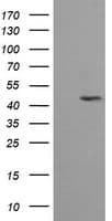 MAP2K2 / MKK2 / MEK2 Antibody (clone OTI1A2)