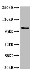 IHC-plus™ Polyclonal Rabbit anti-Human AMPD2 Antibody (IHC, IF)