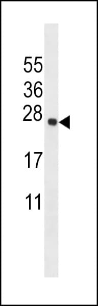 TMEM18 Antibody (aa63-90)