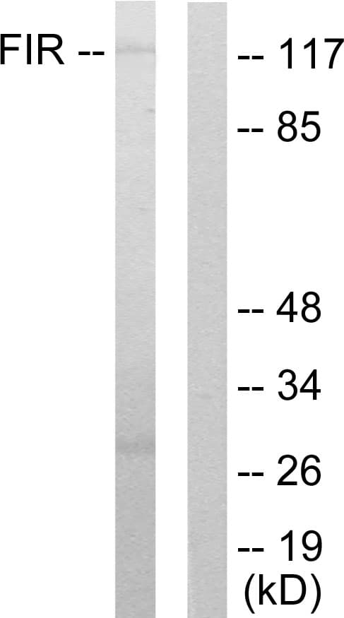Polyclonal Rabbit anti-Human FARP2 / FRG Antibody (aa331-380, WB)