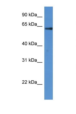 Polyclonal Rabbit anti-Human FLCN / Folliculin Antibody (aa48-97, WB)