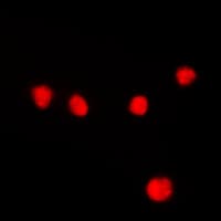 MEF2A / MEF2 Antibody (phospho-Thr312)