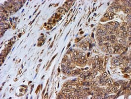 PSMB9 Antibody (aa21-219, clone OTI1D1)