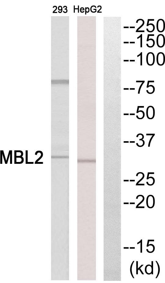 MBL2 / Mannose Binding Protein Antibody