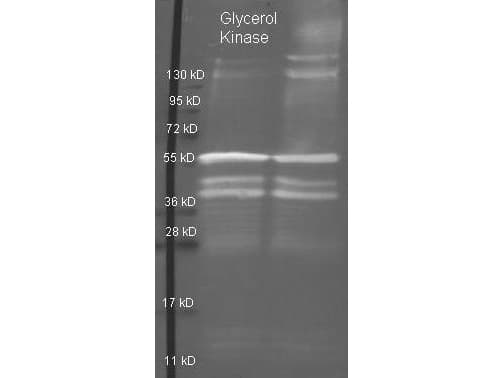 GK / Glycerol Kinase Antibody (Lyophilized, Biotin)