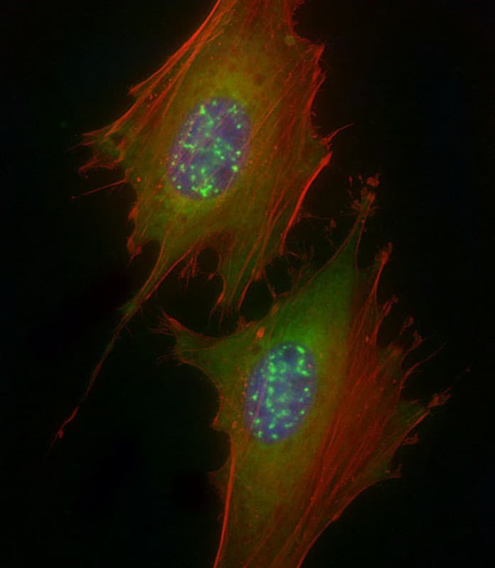 Polyclonal Rabbit anti-Human IRAK1 / IRAK Antibody (phospho-Ser376, IHC, IF, WB)
