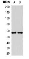 TBX22 Antibody (N-Terminus)