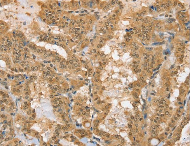 Polyclonal Rabbit anti-Human PSMC1 Antibody (IHC, WB)