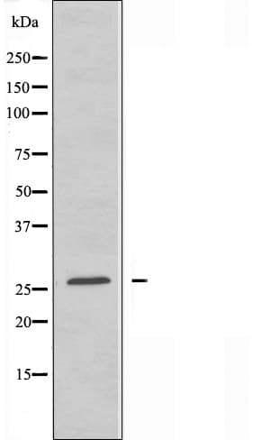 Polyclonal Rabbit anti-Human ATP5H Antibody (IF, WB)