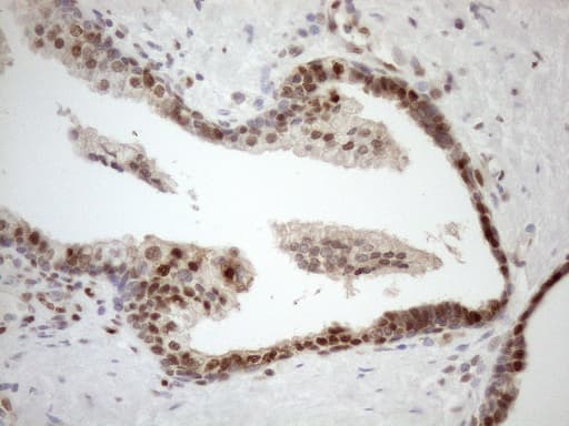 MGMT Antibody (clone OTI5A7)