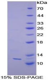 Human Prohibitin Protein (Recombinant His)