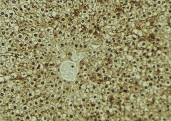 AZIN1 Antibody