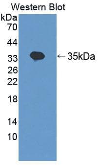 Polyclonal Rabbit anti-Human TNRC6A / GW182 Antibody (Cy3, aa1670-1962, WB)