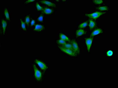 Polyclonal Rabbit anti-Human CD96 / TACTILE Antibody (IHC, IF)