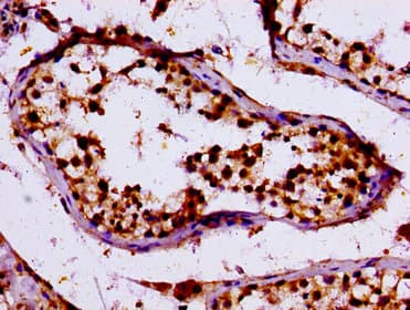Polyclonal Rabbit anti-Human KLF11 Antibody (IHC)