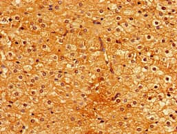 GPI3 / PIGA Antibody