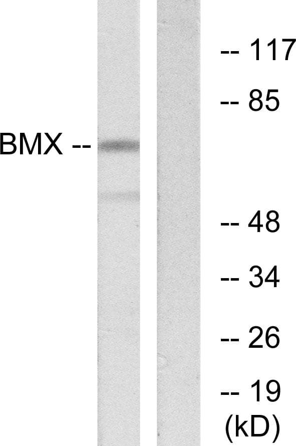 Polyclonal Rabbit anti-Human ETK / BMX Antibody (IHC, IF, WB)