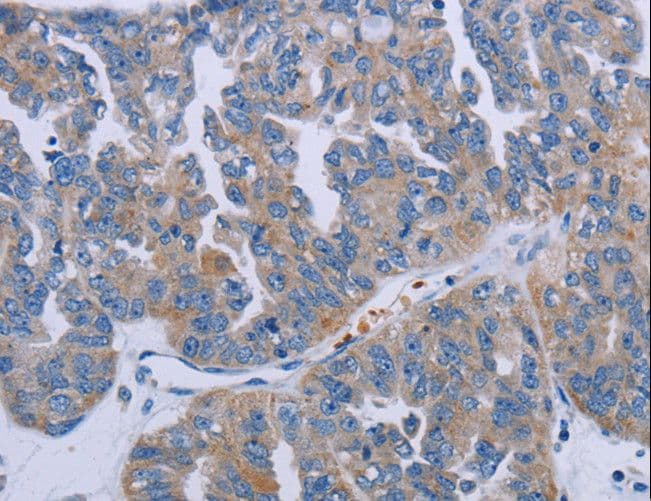 P2RY2 / P2Y2 Antibody