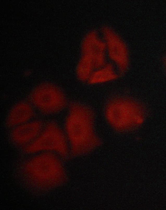 Hamartin / TSC1 Antibody