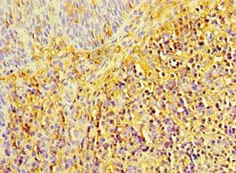 LYZ / Lysozyme Antibody (aa19-148)