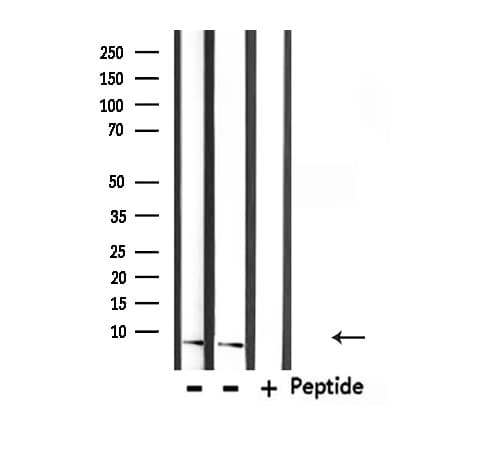 Polyclonal Rabbit anti-Human UBA52 Antibody (IHC, IF, WB)