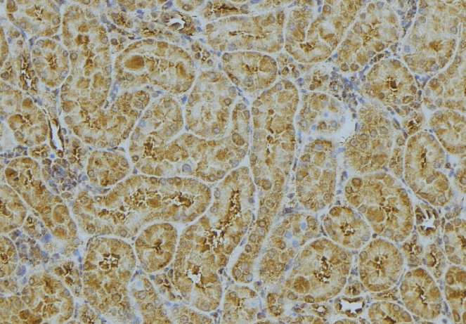 CHMP2A Antibody