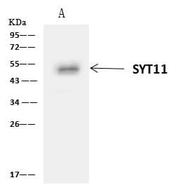 Polyclonal Rabbit anti-Human SYT11 Antibody (IHC, WB)