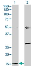 AP2S1 Antibody (clone 3E4)