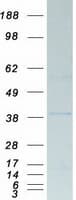 Human PP2Ac / PPP2CA Protein (Recombinant Myc-DDK (Flag))