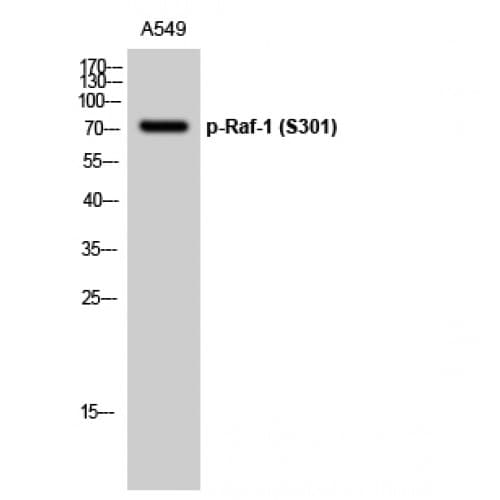 RAF1 / RAF Antibody (240-320 aa)