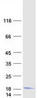 Human HBM Protein (Recombinant Myc-DDK (Flag))