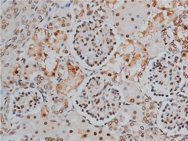 PPP1R12A / MYPT1 Antibody (phospho-Thr853)