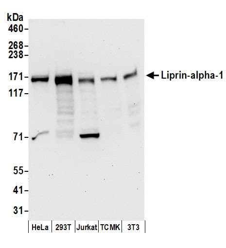 PPFIA1 / LIPRIN Antibody (aa550-600)