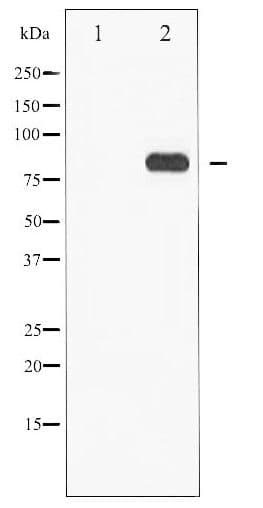 STAT5 A+B Antibody (phospho-Ser725,730)