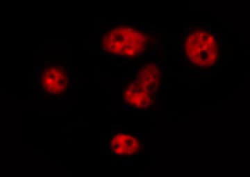 HNRNPC / HNRNP C Antibody