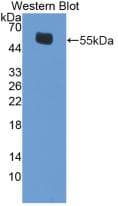 ESR2 / ER Beta Antibody (aa1-530, FITC)