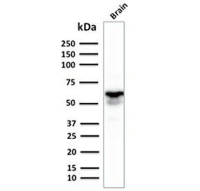 GAD1 / GAD67 Antibody (clone GAD1/2391)