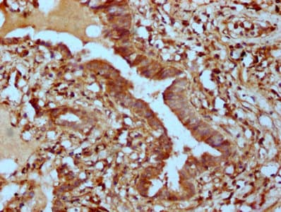 Polyclonal Rabbit anti-Human PHACTR1 Antibody (IHC, IF, WB)