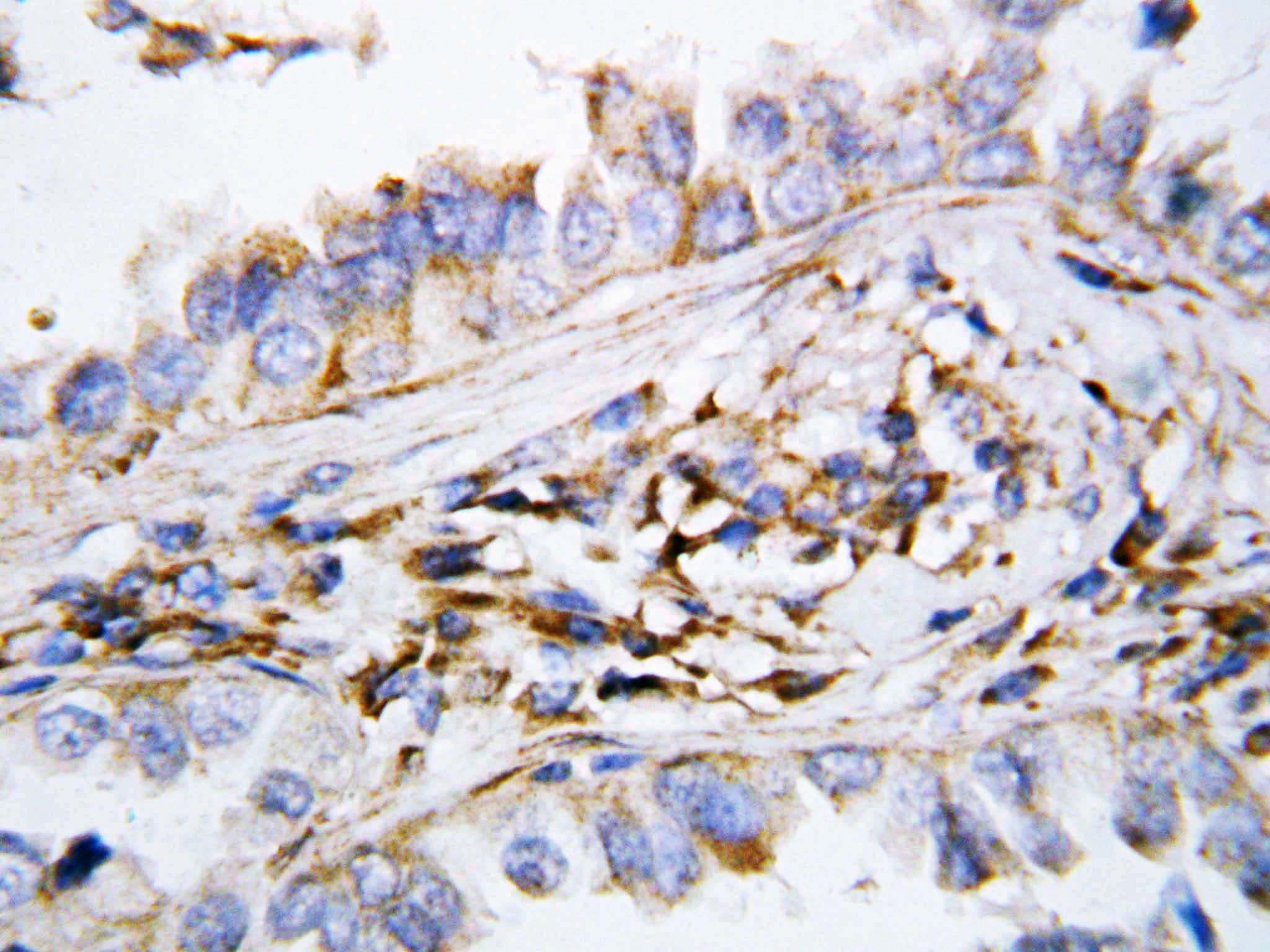 Polyclonal Rabbit anti-Human CXCL9 / MIG Antibody (aa37-51, IHC, WB)