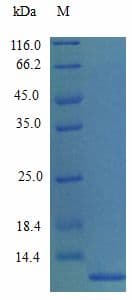 Mouse CCL7 / MCP3 Protein (Recombinant)