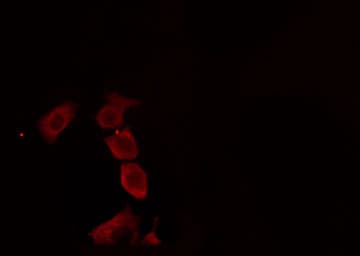 Polyclonal Rabbit anti-Human AVPR2 / V2R Antibody (IF, WB)