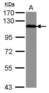 DBN1 / Drebrin Antibody
