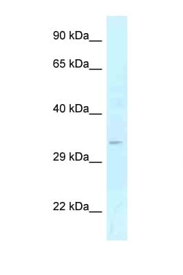 Polyclonal Rabbit anti-Human GOLPH3 Antibody (aa114-163, WB)