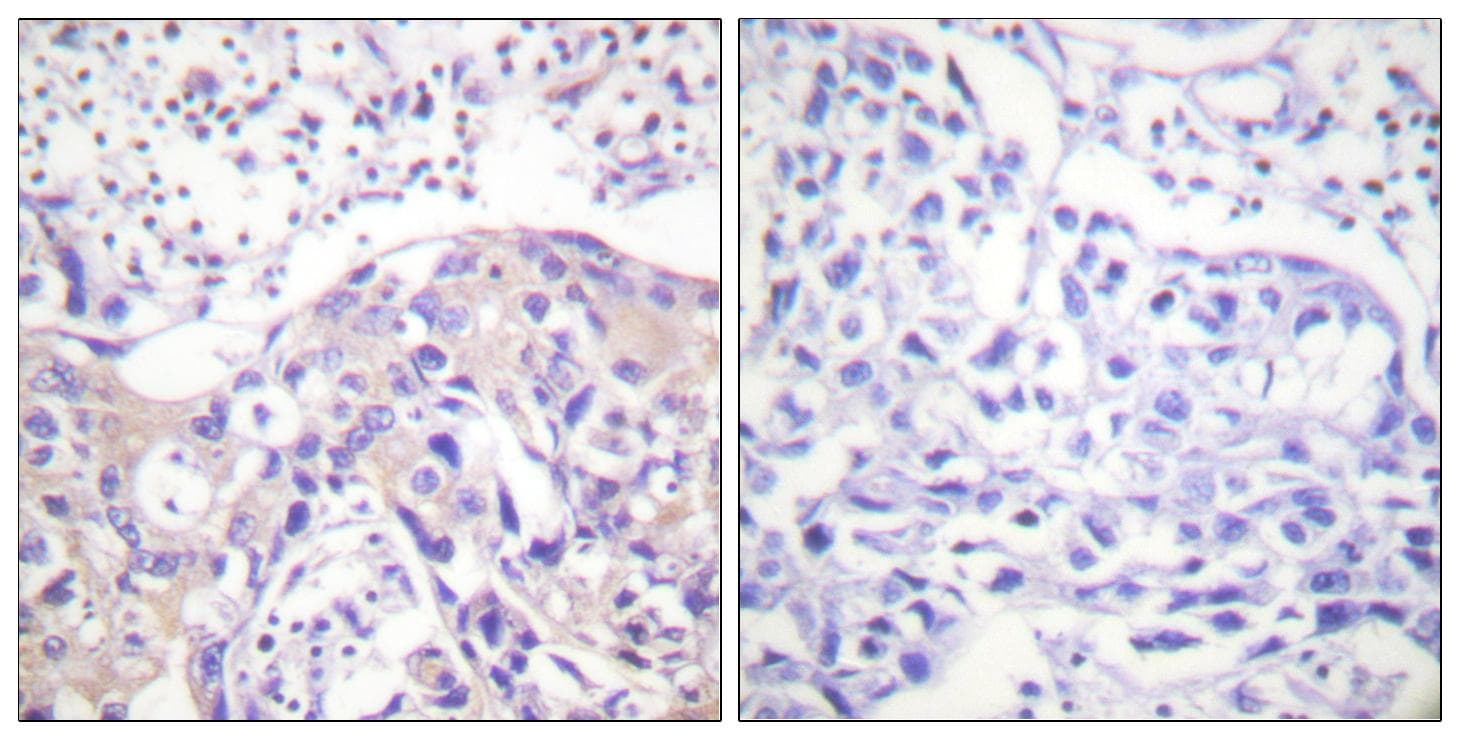 ADD1 / Adducin Alpha Antibody (phospho-Thr445)