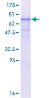 Human RBBP7 / RbAp46 Protein (Recombinant GST)