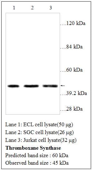 Polyclonal Rabbit anti-Human TS / Thromboxane Synthase Antibody (WB)